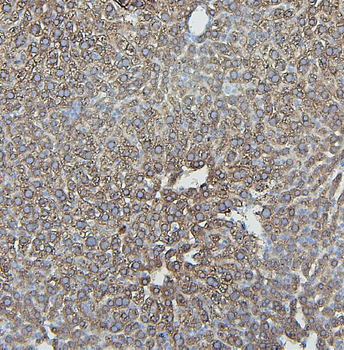 IFNAR2 Rabbit Polyclonal Antibody