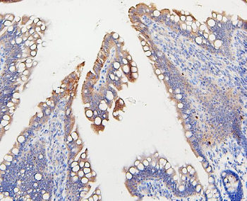 IFNAR2 Rabbit Polyclonal Antibody