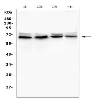 IFNAR2 Rabbit Polyclonal Antibody