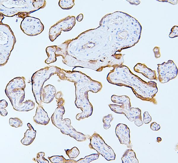 MMP1 Rabbit Polyclonal Antibody