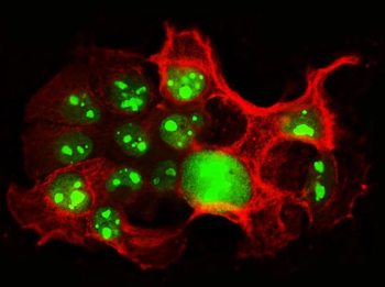 Nucleolin/NCL Rabbit Polyclonal Antibody