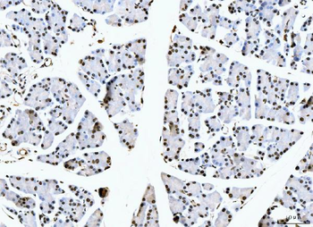 Nucleolin/NCL Rabbit Polyclonal Antibody
