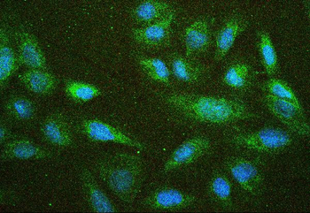 NF2/Merlin Rabbit Polyclonal Antibody