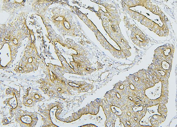 NF2/Merlin Rabbit Polyclonal Antibody