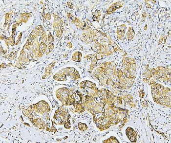 NF2/Merlin Rabbit Polyclonal Antibody