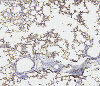NF2/Merlin Rabbit Polyclonal Antibody