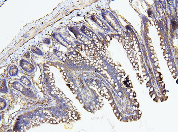 NF2/Merlin Rabbit Polyclonal Antibody