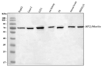 NF2/Merlin Rabbit Polyclonal Antibody