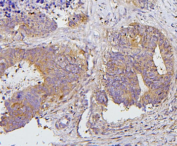 PKC delta/PRKCD Rabbit Polyclonal Antibody