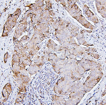 PKC delta/PRKCD Rabbit Polyclonal Antibody