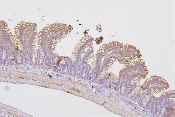 PKC delta/PRKCD Rabbit Polyclonal Antibody