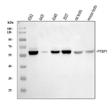 PTBP1 Rabbit Polyclonal Antibody