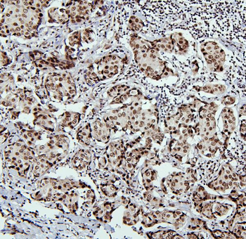 PTBP1 Rabbit Polyclonal Antibody