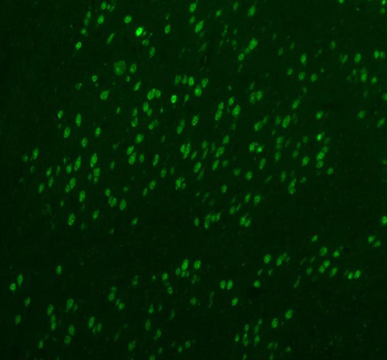 Fox2/RBM9/RBFOX2 Rabbit Polyclonal Antibody