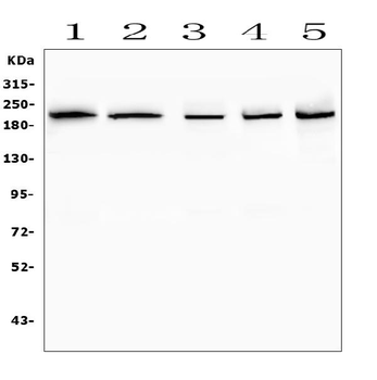 SMARCA2/BRM Rabbit Polyclonal Antibody