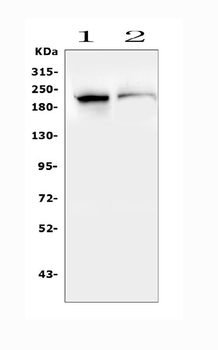 SMARCA2/BRM Rabbit Polyclonal Antibody