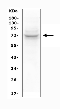 SYK Rabbit Polyclonal Antibody