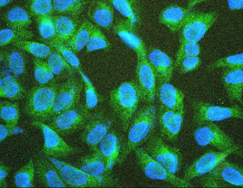 TIE2/TEK Rabbit Polyclonal Antibody