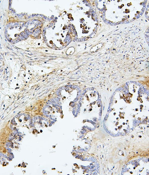 TIE2/TEK Rabbit Polyclonal Antibody