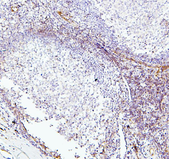 TIE2/TEK Rabbit Polyclonal Antibody