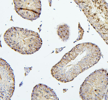 TIE2/TEK Rabbit Polyclonal Antibody