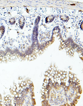 TIE2/TEK Rabbit Polyclonal Antibody