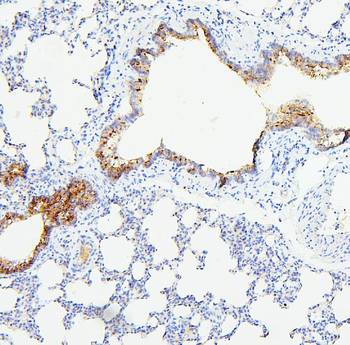 TIE2/TEK Rabbit Polyclonal Antibody