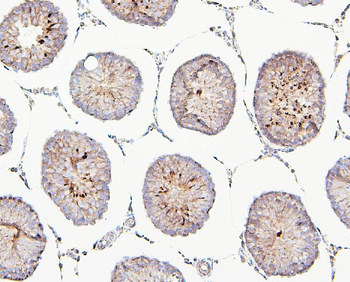 TIE2/TEK Rabbit Polyclonal Antibody