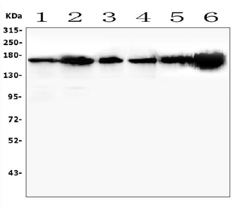 TIE2/TEK Rabbit Polyclonal Antibody