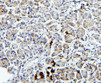 TRPV5 Rabbit Polyclonal Antibody