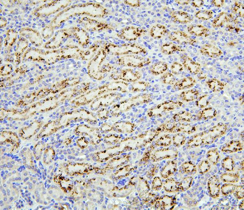 TRPV5 Rabbit Polyclonal Antibody