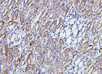 TRPV5 Rabbit Polyclonal Antibody