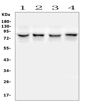 TRPV5 Rabbit Polyclonal Antibody