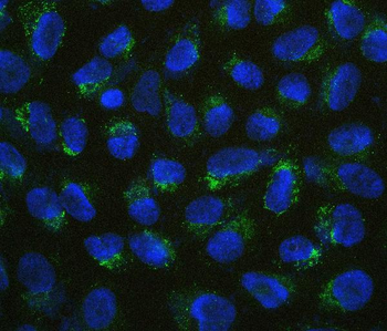 B7H4/VTCN1 Rabbit Polyclonal Antibody