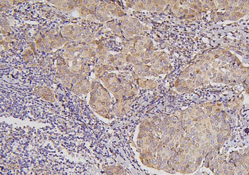 B7H4/VTCN1 Rabbit Polyclonal Antibody