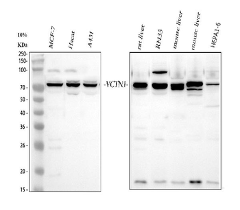 B7H4/VTCN1 Rabbit Polyclonal Antibody