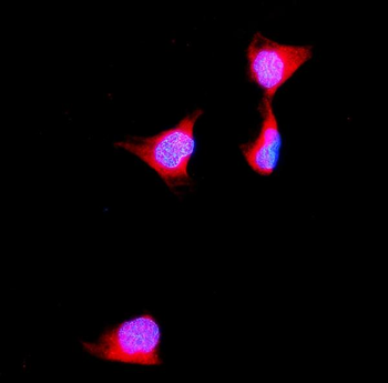 Aldolase/ALDOB Rabbit Polyclonal Antibody