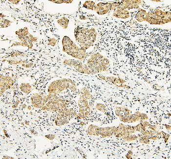 ATRX Rabbit Polyclonal Antibody