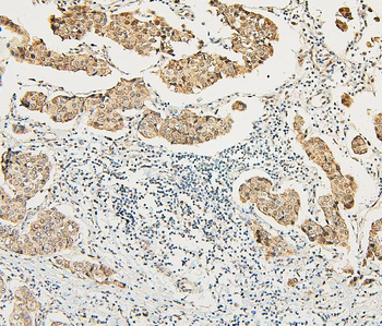 ATRX Rabbit Polyclonal Antibody