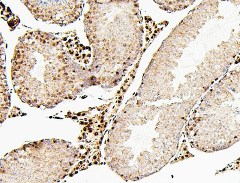 ATRX Rabbit Polyclonal Antibody