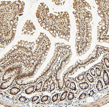 ATRX Rabbit Polyclonal Antibody