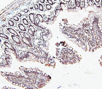 ATRX Rabbit Polyclonal Antibody