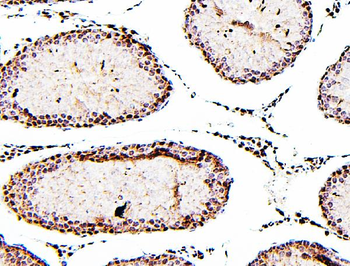 ATRX Rabbit Polyclonal Antibody