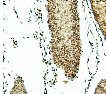 ATRX Rabbit Polyclonal Antibody