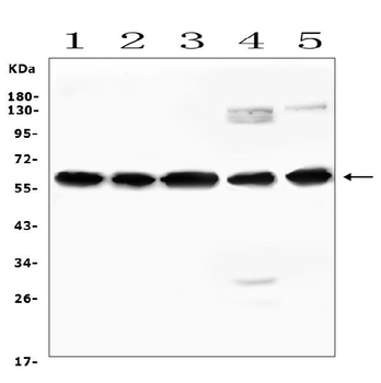AVPR1A/V1aR Rabbit Polyclonal Antibody