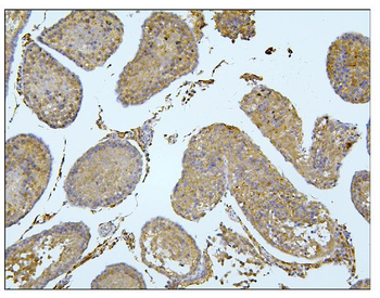 BubR1/BUB1B Rabbit Polyclonal Antibody