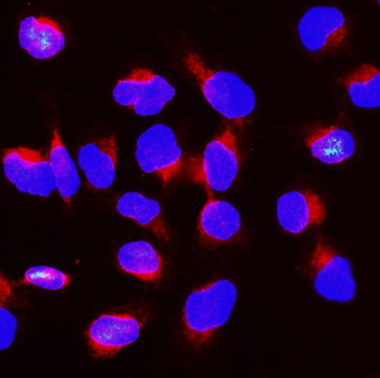 BubR1/BUB1B Rabbit Polyclonal Antibody