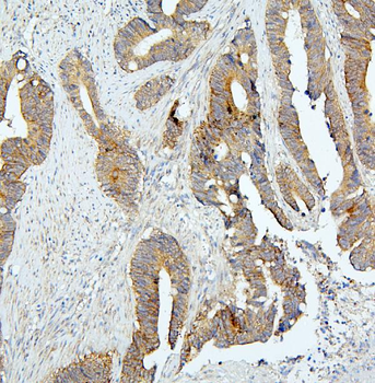 BubR1/BUB1B Rabbit Polyclonal Antibody