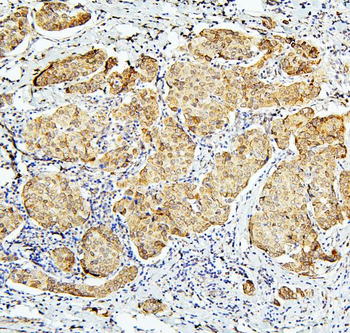 BubR1/BUB1B Rabbit Polyclonal Antibody