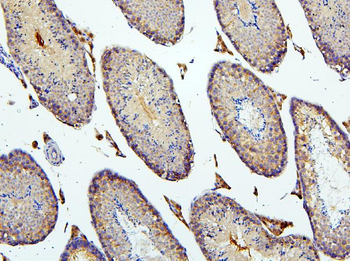 BubR1/BUB1B Rabbit Polyclonal Antibody
